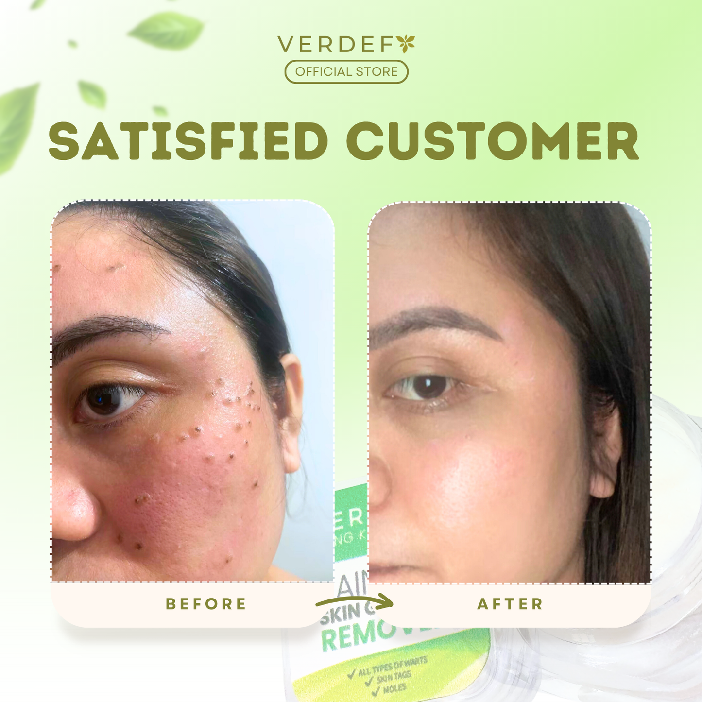 VERDEFY NEW STRONG KASOY CREAM