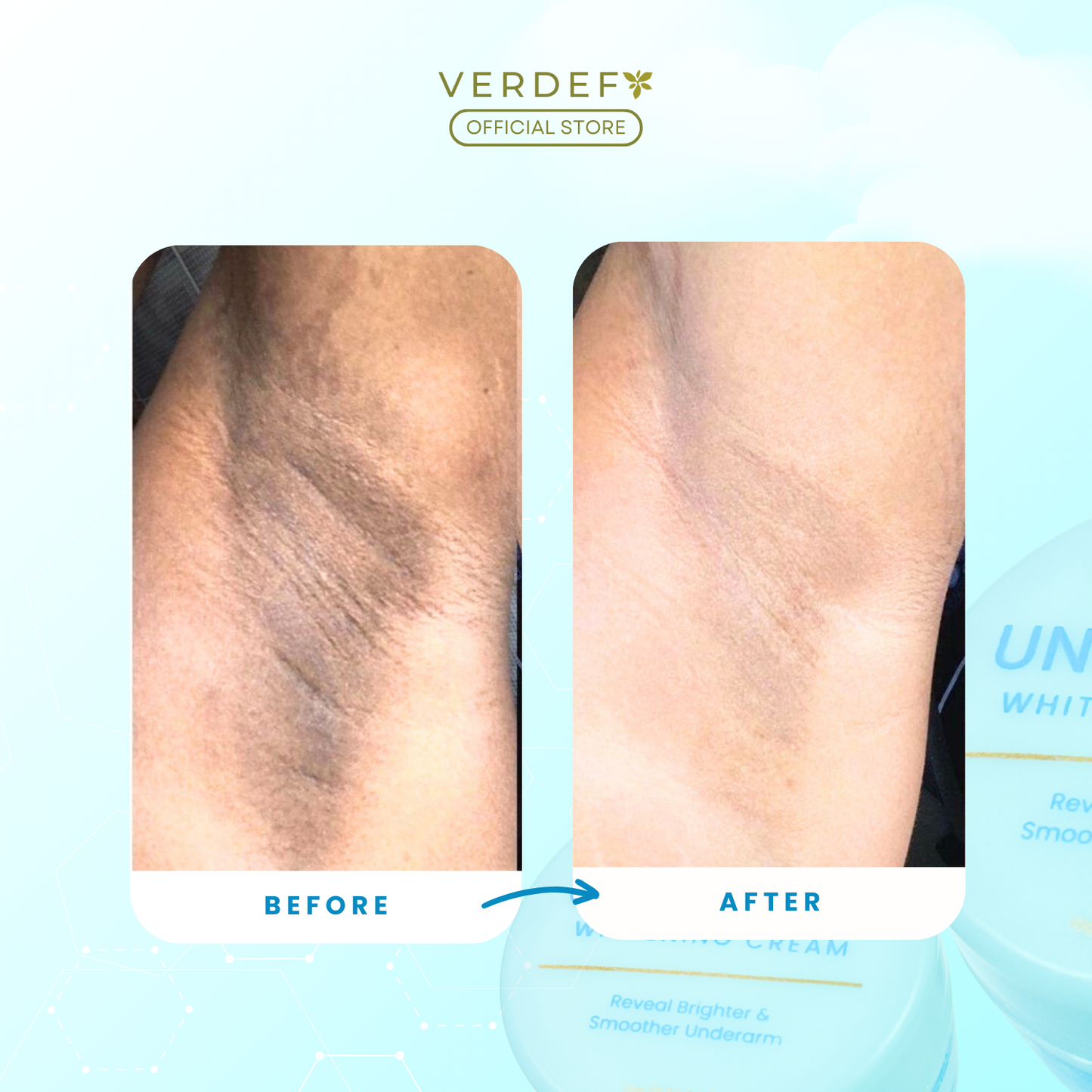 VERDEFY UNDERARM WHITENING CREAM
