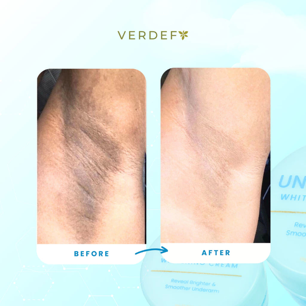 VERDEFY UNDERARM WHITENING CREAM