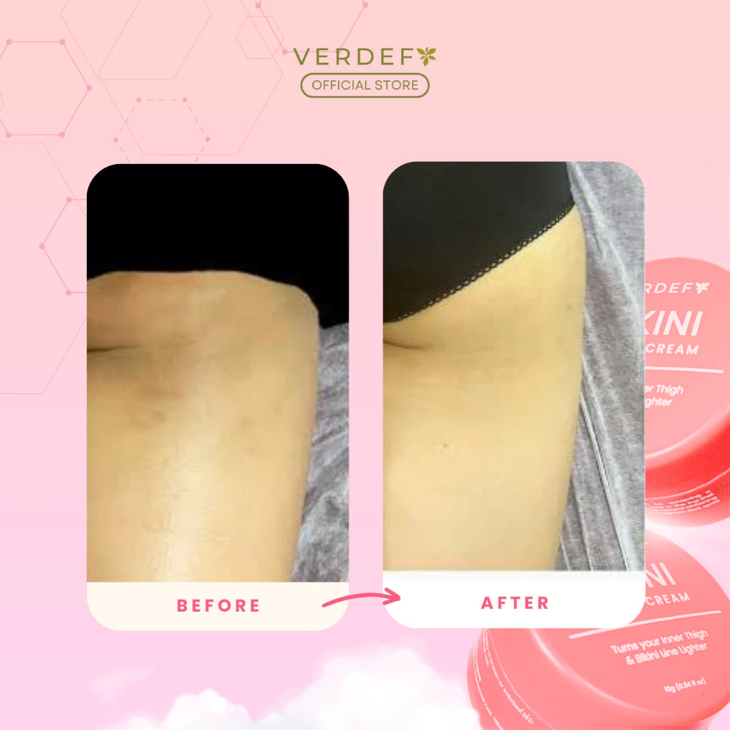 VERDEFY GLOW UP KIT