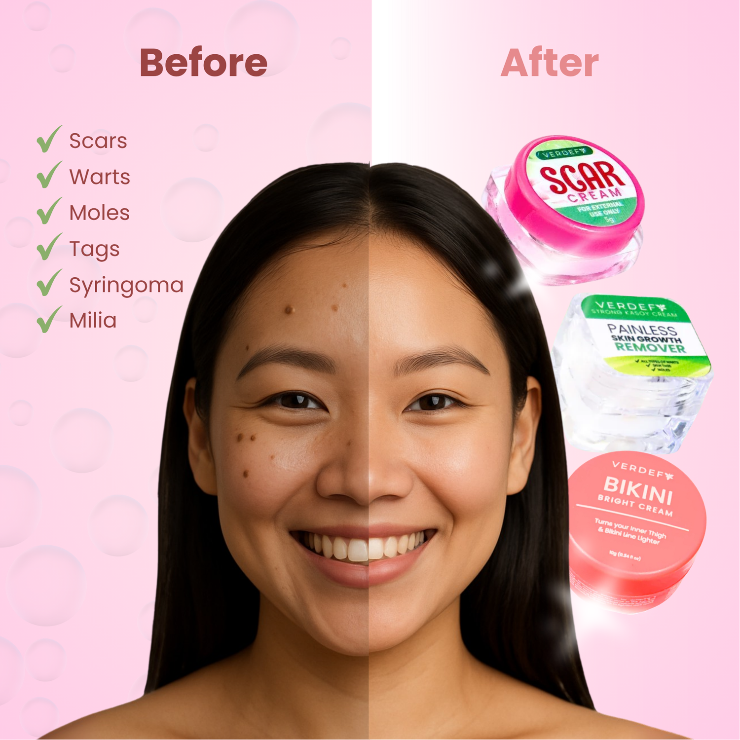 Scar and Warts Remover