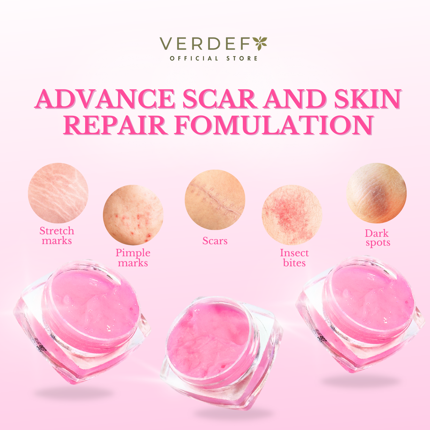 VERDEFY SCAR CREAM 5G