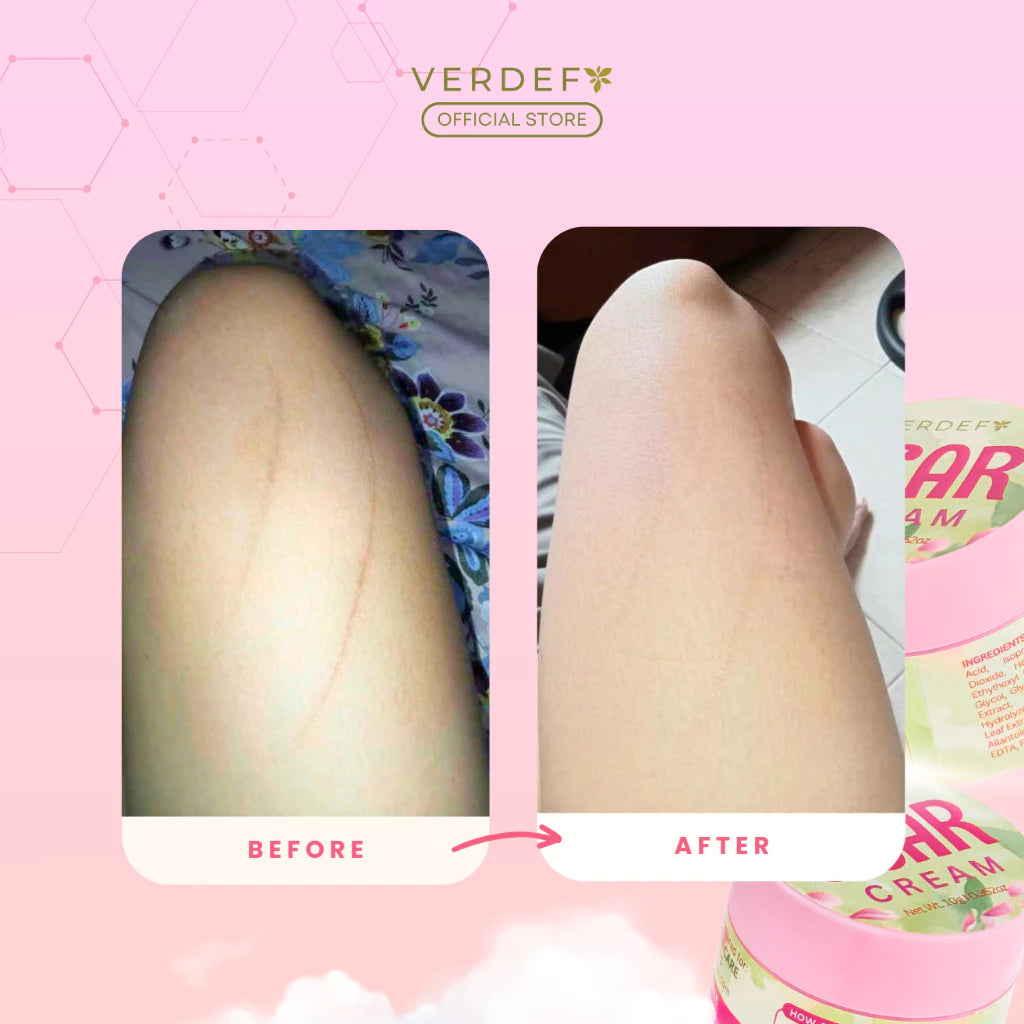 VERDEFY GLOW UP KIT