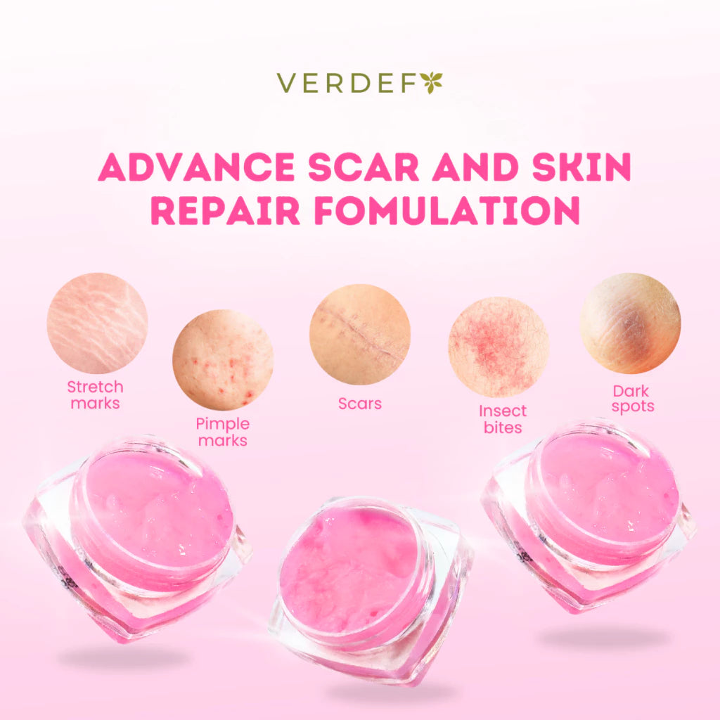VERDEFY SCAR CREAM 5G